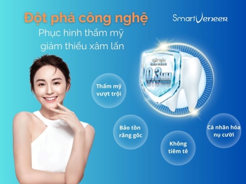 Dán sứ Smart Veneer – Dán sứ một lần đẹp trọn đời